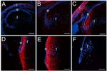 CD44 Antibody in Immunohistochemistry (IHC)