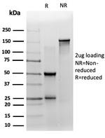 ZNF358 (Zinc Finger Protein 358) (Transcription Factor) Antibody in SDS-PAGE (SDS-PAGE)