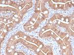 S100A16 (S100 calcium binding protein A16) Antibody in Immunohistochemistry (Paraffin) (IHC (P))