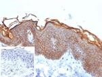 S100A16 (S100 calcium binding protein A16) Antibody in Immunohistochemistry (Paraffin) (IHC (P))