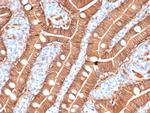 S100A16 (S100 calcium binding protein A16) Antibody in Immunohistochemistry (Paraffin) (IHC (P))