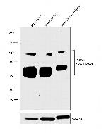 CD62E (E-selectin) Antibody in Western Blot (WB)