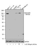 CD66e (CEA) Antibody in Western Blot (WB)