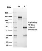 ZBTB46/BTBD4/ZNF340 Antibody in SDS-PAGE (SDS-PAGE)