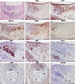 CD8a Antibody in Immunohistochemistry (IHC)