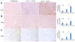 CD8a Antibody in Immunohistochemistry (IHC)