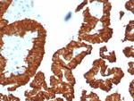 Crystallin Alpha B Antibody in Immunohistochemistry (Paraffin) (IHC (P))