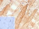 Crystallin Alpha B Antibody in Immunohistochemistry (Paraffin) (IHC (P))