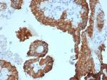 Crystallin Alpha B Antibody in Immunohistochemistry (Paraffin) (IHC (P))