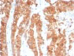 Crystallin Alpha B Antibody in Immunohistochemistry (Paraffin) (IHC (P))