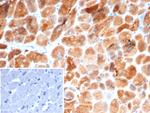 Crystallin Alpha B Antibody in Immunohistochemistry (Paraffin) (IHC (P))