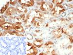 Crystallin Alpha B Antibody in Immunohistochemistry (Paraffin) (IHC (P))