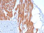 Crystallin Alpha B Antibody in Immunohistochemistry (Paraffin) (IHC (P))