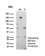 Crystallin Alpha B Antibody in SDS-PAGE (SDS-PAGE)