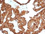 Crystallin Alpha B Antibody in Immunohistochemistry (Paraffin) (IHC (P))