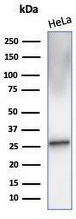 Crystallin Alpha B Antibody in Western Blot (WB)