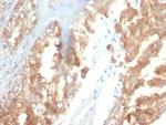 Crystallin Alpha B Antibody in Immunohistochemistry (Paraffin) (IHC (P))