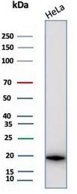 Crystallin Alpha B Antibody in Western Blot (WB)