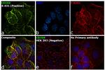 CD104 (Integrin beta 4) Antibody in Immunocytochemistry (ICC/IF)