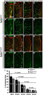 CD140b (PDGFRB) Antibody in Immunohistochemistry (IHC)