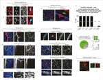 CD140b (PDGFRB) Antibody in Immunohistochemistry (IHC)