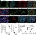 CD140b (PDGFRB) Antibody in Immunohistochemistry (IHC)