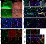 CD140b (PDGFRB) Antibody in Immunohistochemistry (IHC)