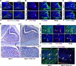 CD140b (PDGFRB) Antibody in Immunohistochemistry (IHC)