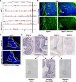 CD140b (PDGFRB) Antibody in Immunohistochemistry (IHC)