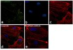 CD144 (VE-cadherin) Antibody in Immunocytochemistry (ICC/IF)