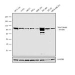 beta Catenin Antibody in Western Blot (WB)