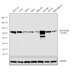 beta Catenin Antibody in Western Blot (WB)