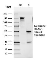 GM-CSF (Granulocyte/Macrophage - Colony Stimulating Factor) Antibody in SDS-PAGE (SDS-PAGE)