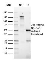 GM-CSF (Granulocyte/Macrophage - Colony Stimulating Factor) Antibody in SDS-PAGE (SDS-PAGE)