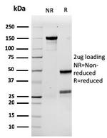 Granulocyte-Colony Stimulating Factor (G-CSF) Antibody in SDS-PAGE (SDS-PAGE)