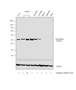 beta-3 Tubulin Antibody in Western Blot (WB)