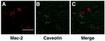 Galectin 3 Antibody in Immunocytochemistry (ICC/IF)