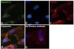 Galectin 3 Antibody in Immunocytochemistry (ICC/IF)