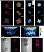 Podoplanin Antibody in Immunocytochemistry (ICC/IF)