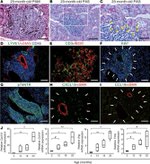 CD45 Antibody in Immunohistochemistry (Paraffin) (IHC (P))