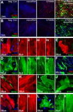 Ki-67 Antibody in Immunohistochemistry (IHC)