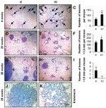 Endomucin Antibody in Immunohistochemistry (IHC)