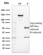 ZNF690/ZSCAN29 Antibody in SDS-PAGE (SDS-PAGE)