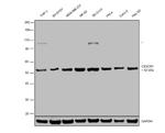 CX3CR1 Antibody in Western Blot (WB)