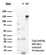 Neuronal-Nuclei (NeuN) (Neuronal Marker) Antibody in SDS-PAGE (SDS-PAGE)