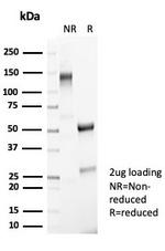 Neuronal-Nuclei (NeuN) (Neuronal Marker) Antibody in SDS-PAGE (SDS-PAGE)