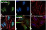 NFkB p65 Antibody