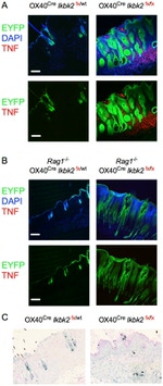 TNF alpha Antibody in Immunohistochemistry (IHC)