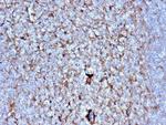 Cystatin A Antibody in Immunohistochemistry (Paraffin) (IHC (P))