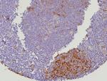 Cystatin A Antibody in Immunohistochemistry (Paraffin) (IHC (P))